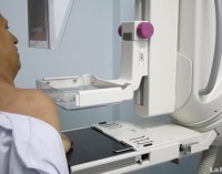 El tratamiento del cáncer de mama en Yecla depende de una puerta