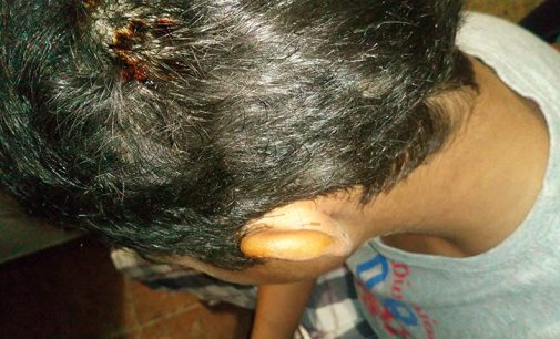Un niño de 12 años resulta herido tras ser atacado por un perro